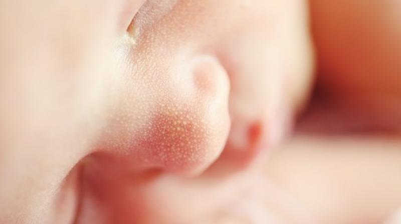 There is robust evidence that very preterm or very low birth weight individuals have an increased risk of ADHD. (Photo: Pixabay) There is robust evidence that very preterm or very low birth weight individuals have an increased risk of ADHD. (Photo: Pixabay)
