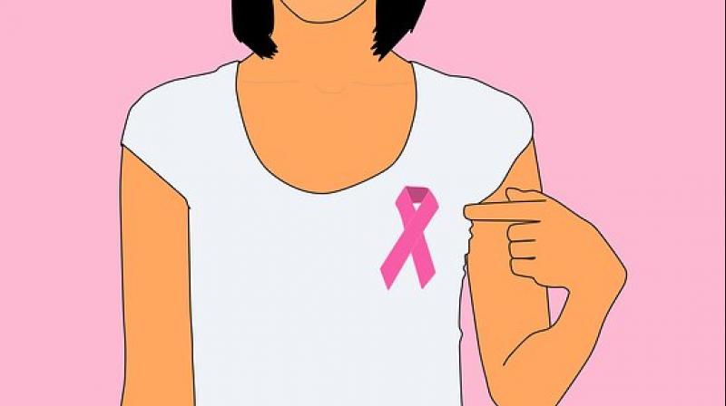 It's urgent to have a national breast cancer program in India, while at the local level, awareness needs to be raised about breast cancer. (Photo: Pixabay) It's urgent to have a national breast cancer program in India, while at the local level, awareness needs to be raised about breast cancer. (Photo: Pixabay)
