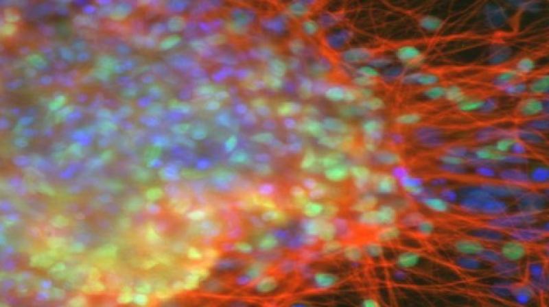 The study was published in the journal Gastroenterology. (Photo: ANI) The study was published in the journal Gastroenterology. (Photo: ANI)