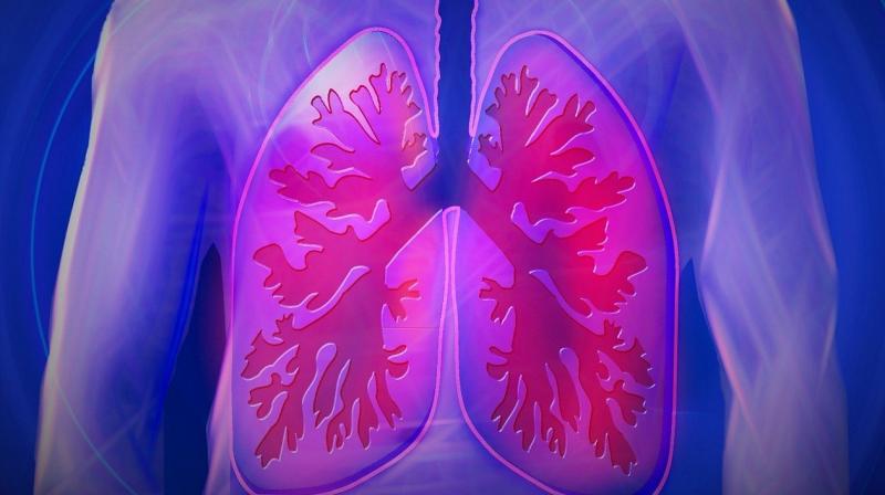 : Staying physically fit can help you become strong, agile and also strengthen your respiratory muscles. (Photo: Representational/Pixabay) : Staying physically fit can help you become strong, agile and also strengthen your respiratory muscles. (Photo: Representational/Pixabay)