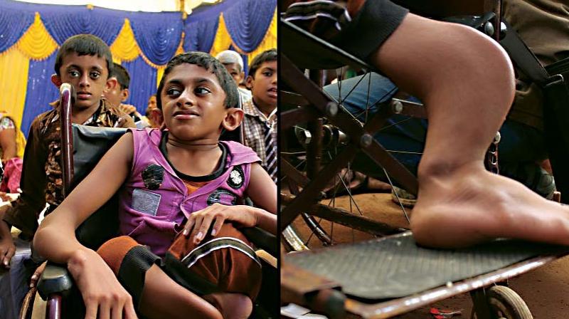 A file photo of an endosulfan victim A file photo of an endosulfan victim