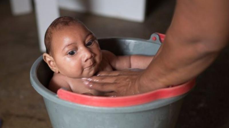The Zika virus causes devastating birth defects and pregnancy losses even if a woman had only a minor illness. (Photo: AP) The Zika virus causes devastating birth defects and pregnancy losses even if a woman had only a minor illness. (Photo: AP)