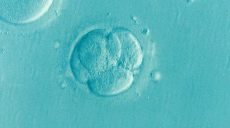 Expert addresses misconceptions of IVF. (Photo: Pixabay) Expert addresses misconceptions of IVF. (Photo: Pixabay)