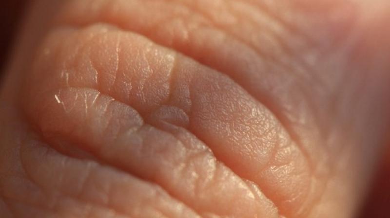 The cells that make up the organ are highly sensitive to mechanical stimuli, which explain how they can participate in the detection of painful pinpricks and pressure. (Photo: ANI) The cells that make up the organ are highly sensitive to mechanical stimuli, which explain how they can participate in the detection of painful pinpricks and pressure. (Photo: ANI)