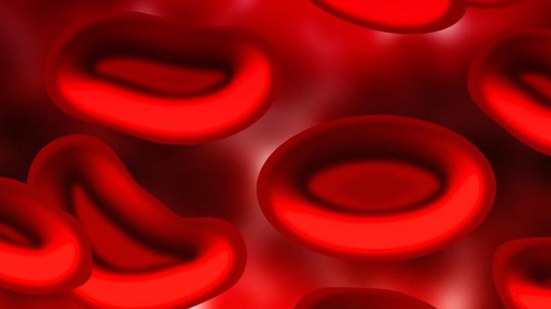 Scientists develop new method to screen cervical cancer. (Photo: Pixabay) Scientists develop new method to screen cervical cancer. (Photo: Pixabay)