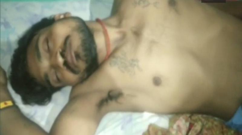Rajkumar, who hails from Etah's Asrauli village, was in an inebriated condition when he bit the snake. (Photo: ANI) Rajkumar, who hails from Etah's Asrauli village, was in an inebriated condition when he bit the snake. (Photo: ANI)