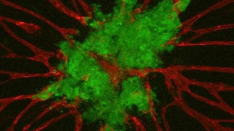 Using an innovative modelling system in mice, the researchers visually tagged colon cancer mutations by causing stem cells to glow. (Photo: ANI)