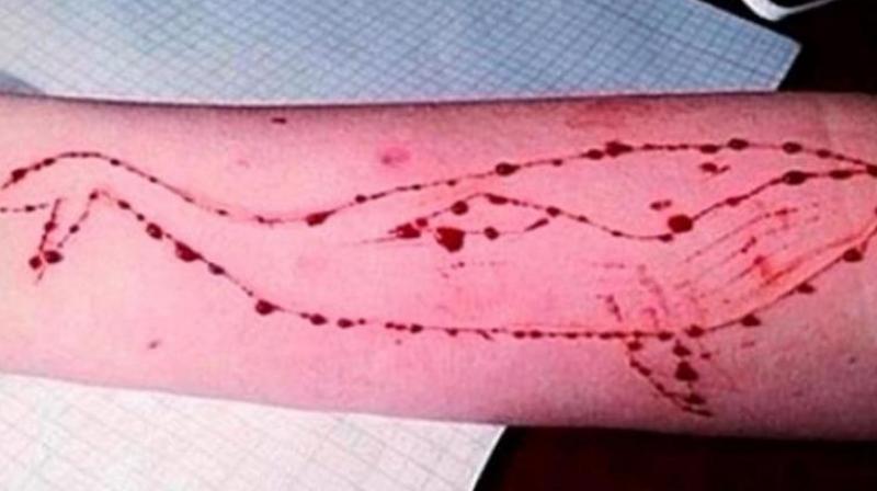 The online game, which originated in Russia, starts by asking participants via social media to take self-harming tasks. (Photo: Social Media) The online game, which originated in Russia, starts by asking participants via social media to take self-harming tasks. (Photo: Social Media)