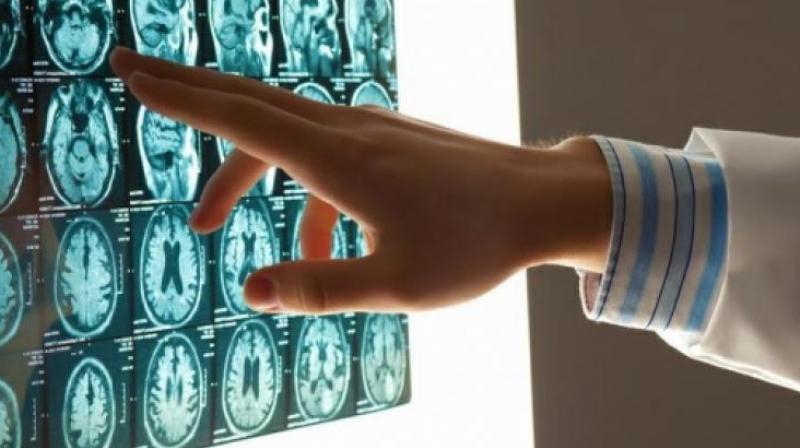 Study finds your gender matters when it comes to concussions. (Photo: AFP) Study finds your gender matters when it comes to concussions. (Photo: AFP)