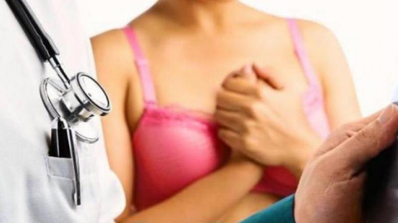 Signs of breast cancer that has become an epidemic in India. (Photo: AFP) Signs of breast cancer that has become an epidemic in India. (Photo: AFP)