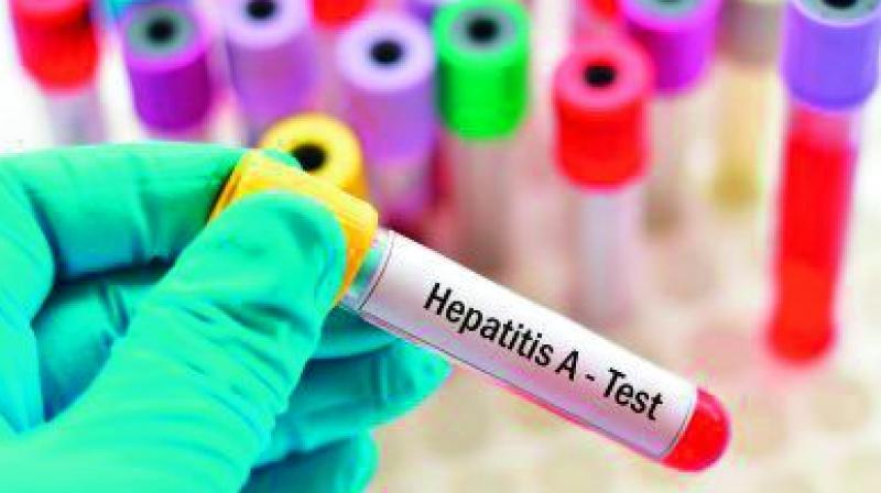 HAV infection is caused by ingesting water or food contaminated by faecal matter or from being in close contact with someone who has been infected. HAV infection is caused by ingesting water or food contaminated by faecal matter or from being in close contact with someone who has been infected.