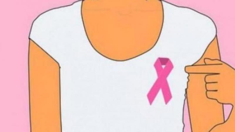 Researchers say breast cancer death rates declined due to better treatment. (Photo: Pixabay) Researchers say breast cancer death rates declined due to better treatment. (Photo: Pixabay)