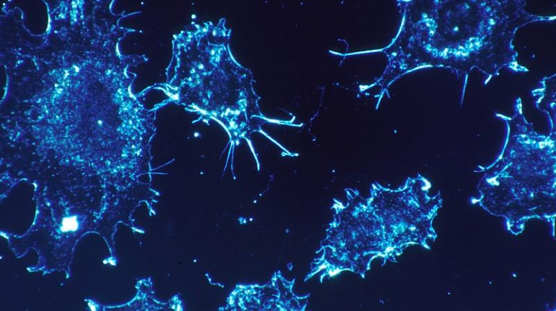 The treatment is less toxic than traditional chemotherapy because it more selectively targets cancerous cells, blocking their ability to multiply. (Photo: Representational/Pixabay) The treatment is less toxic than traditional chemotherapy because it more selectively targets cancerous cells, blocking their ability to multiply. (Photo: Representational/Pixabay)