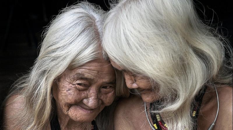 As you age, most of your cells are ratcheting down and losing function, and they stop growing. (Photo: Pixabay) As you age, most of your cells are ratcheting down and losing function, and they stop growing. (Photo: Pixabay)