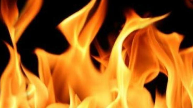 Singh, a member of a below poverty line (BPL) family, died of burn injuries at SCB Medical College and Hospital (Representational image) Singh, a member of a below poverty line (BPL) family, died of burn injuries at SCB Medical College and Hospital (Representational image)