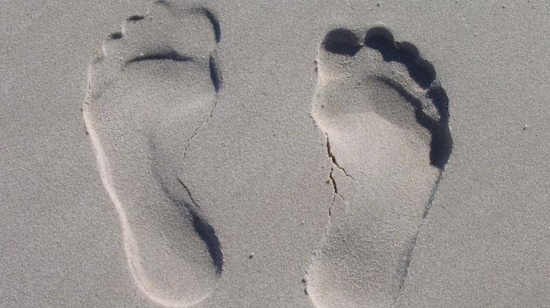 Custom-made foot orthoses no better than cheaper insoles. (Photo: Pixabay) Custom-made foot orthoses no better than cheaper insoles. (Photo: Pixabay)