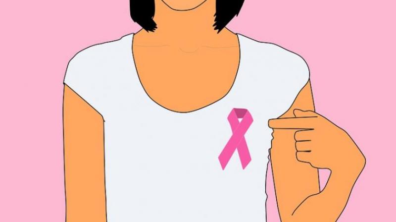 Scientists discover way to treat aggressive forms of breast cancer. (Photo: Pixabay) Scientists discover way to treat aggressive forms of breast cancer. (Photo: Pixabay)