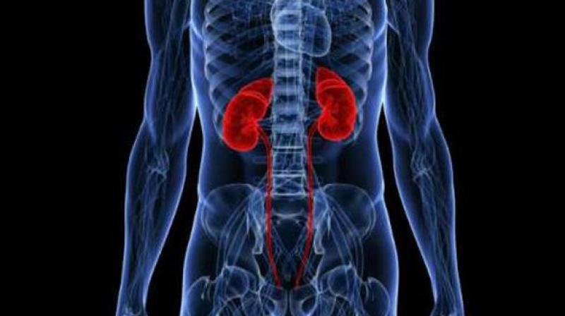 Kidney transplant is a scarce resource, and it is important that scarce medical resources be distributed fairly. (Representational Image) Kidney transplant is a scarce resource, and it is important that scarce medical resources be distributed fairly. (Representational Image)