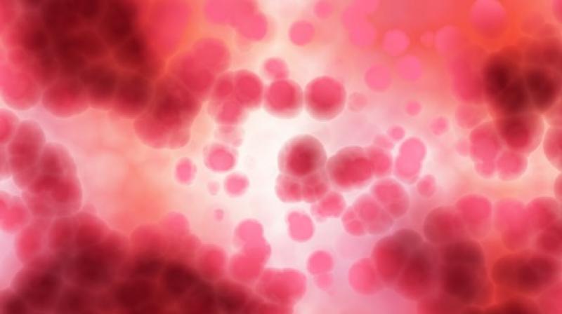 Researchers link iron supplements to colon cancer. (Photo: Pixabay) Researchers link iron supplements to colon cancer. (Photo: Pixabay)