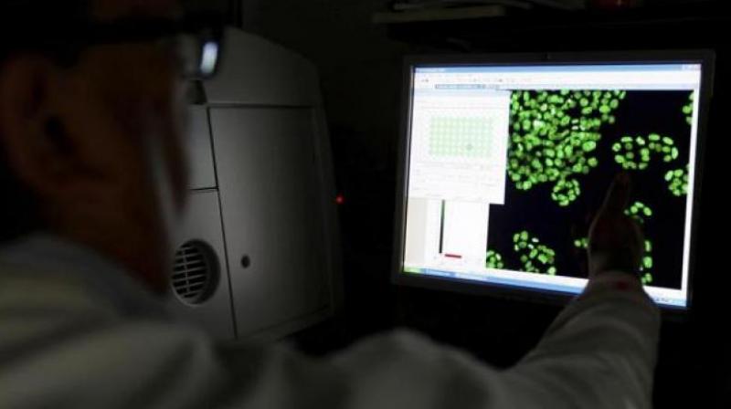 Earlier research has also branded the gut as our second brain because of the impact it has on our mood (Photo: AFP) Earlier research has also branded the gut as our second brain because of the impact it has on our mood (Photo: AFP)