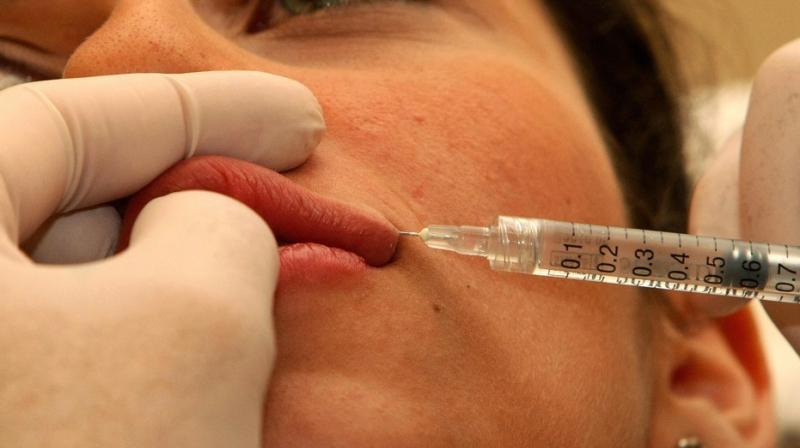 A cosmetic-surgery expert told her that she may lose her lip if the tissue started dying (Photo: AFP) A cosmetic-surgery expert told her that she may lose her lip if the tissue started dying (Photo: AFP)