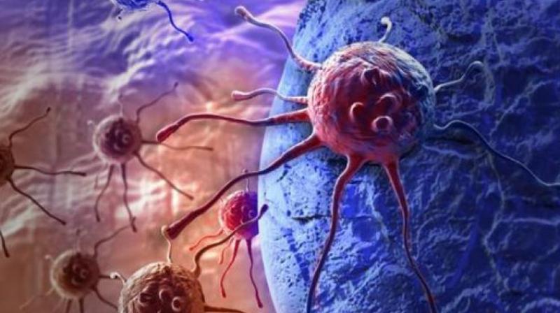 The surface of these nanocarriers or drug capsules is specially coated to enable them to dock on to tissue interspersed with tumour cells (Photo: Pixabay) The surface of these nanocarriers or drug capsules is specially coated to enable them to dock on to tissue interspersed with tumour cells (Photo: Pixabay)