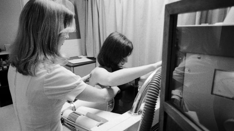 Some diagnostic and treatment options such as mammography and radiotherapy are often not available in poor countries. (Photo: AP) Some diagnostic and treatment options such as mammography and radiotherapy are often not available in poor countries. (Photo: AP)