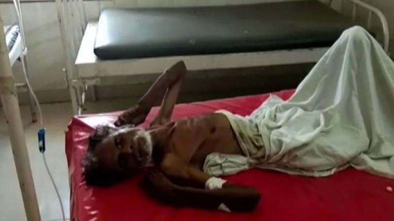 Man who was declared dead by a doctor at a government hospital in Sagar district. (Photo: ANI) Man who was declared dead by a doctor at a government hospital in Sagar district. (Photo: ANI)