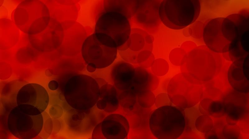 Ovarian cancers start in the fallopian tubes, researchers find. (Photo: Pixabay) Ovarian cancers start in the fallopian tubes, researchers find. (Photo: Pixabay)