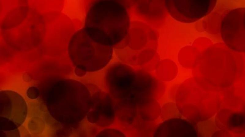 Urologist Dr Ramkrishna Prasad said that 95 per cent of prostate cancers are curable if they are identified at an early stage. Urologist Dr Ramkrishna Prasad said that 95 per cent of prostate cancers are curable if they are identified at an early stage.