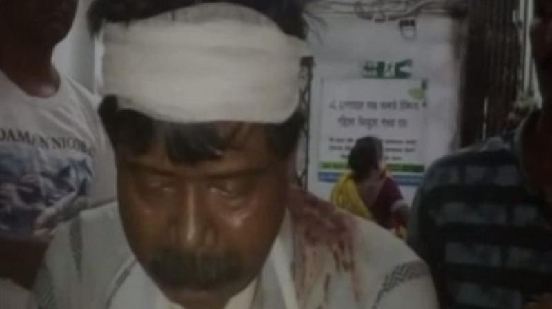 The BJP workers have alleged that they were beaten up by TMC supporters, while the TMC workers have claimed that BJP supporters threw bombs at them. (Photo: ANI) The BJP workers have alleged that they were beaten up by TMC supporters, while the TMC workers have claimed that BJP supporters threw bombs at them. (Photo: ANI)