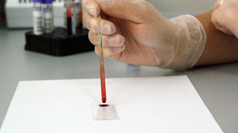 Researchers discover myeloma treatment delays cancer progression. (Photo: Pixabay) Researchers discover myeloma treatment delays cancer progression. (Photo: Pixabay)