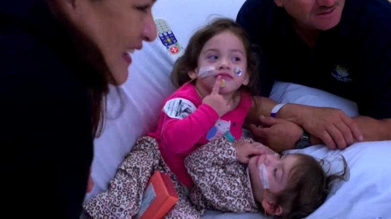 The girls are expected to remain in the intensive care unit at the hospital for two weeks (Photo: YouTube) The girls are expected to remain in the intensive care unit at the hospital for two weeks (Photo: YouTube)