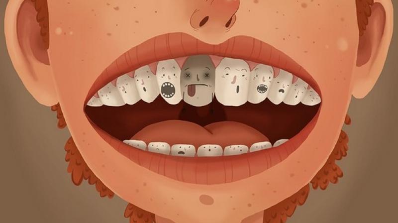 All three different ways of treating decay were acceptable to children, parents and dental professionals. (Photo: ANI) All three different ways of treating decay were acceptable to children, parents and dental professionals. (Photo: ANI)