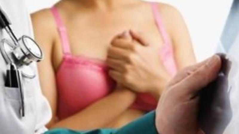 Women who got reconstruction also tended to have less advanced cancer than women who only got a mastectomy (Photo: AFP) Women who got reconstruction also tended to have less advanced cancer than women who only got a mastectomy (Photo: AFP)