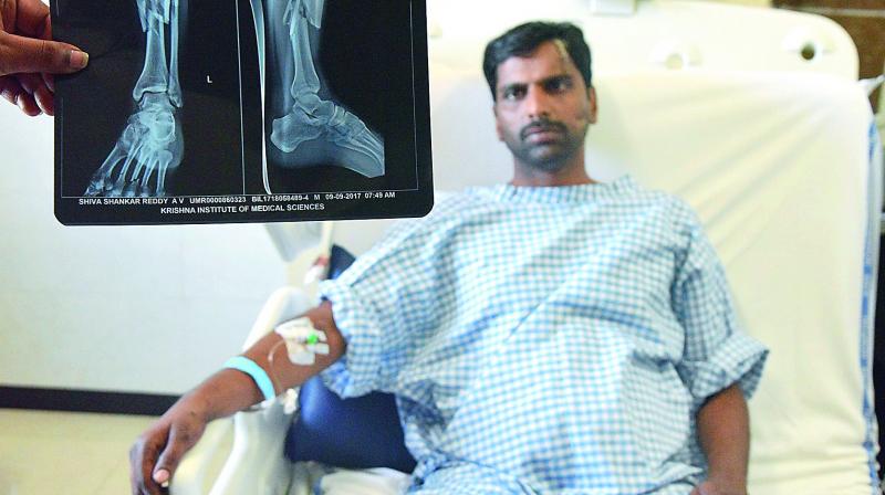 An injured Shiv Shankar Reddy lies on the hospital bed. An injured Shiv Shankar Reddy lies on the hospital bed.