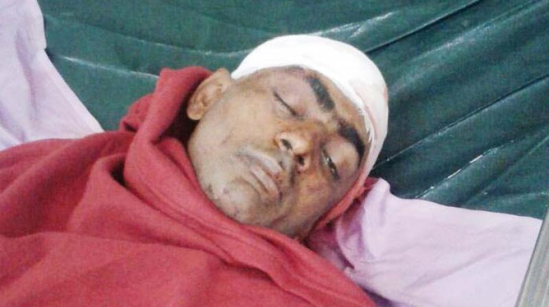 Victim, Musheer (28), at the hospital. Victim, Musheer (28), at the hospital.