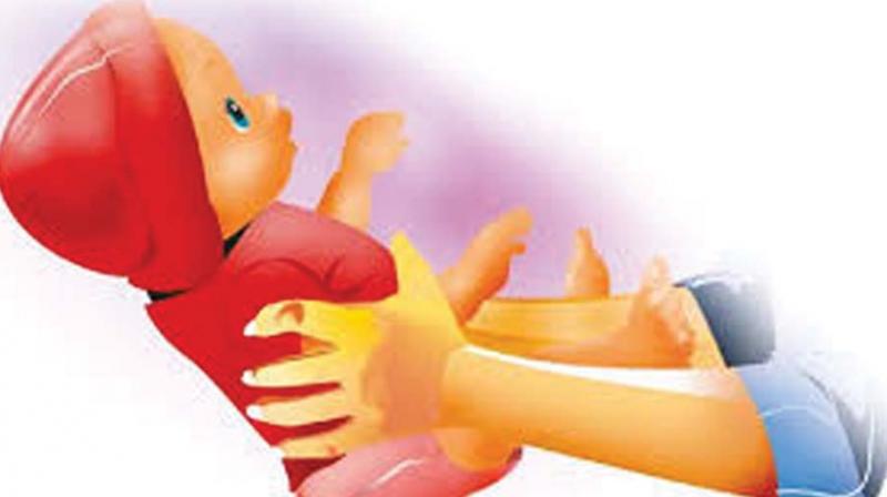 Baby was born with a deformity in his right hand despite all pre-natal reports showing no abnormalities. (Representational Image) Baby was born with a deformity in his right hand despite all pre-natal reports showing no abnormalities. (Representational Image)