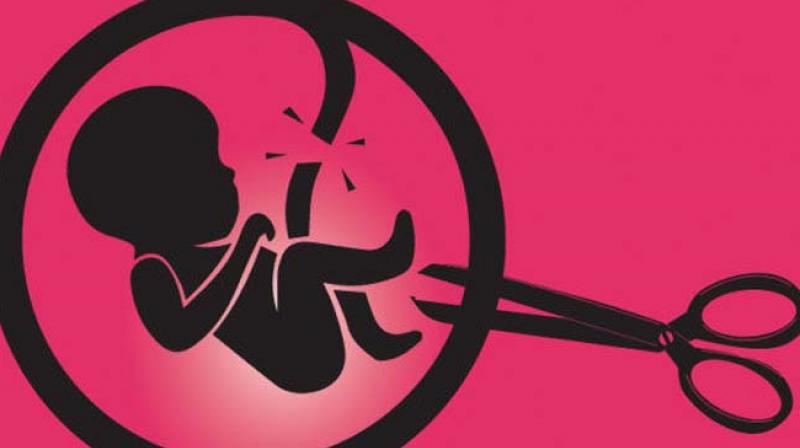 A recent survey has revealed that as many as 38.7% of married couples opt for female sterilization as opposed to male sterilization which is at a mere 0.2%. The survey covered married women in urban Bengaluru between the age of 15 and 49. A recent survey has revealed that as many as 38.7% of married couples opt for female sterilization as opposed to male sterilization which is at a mere 0.2%. The survey covered married women in urban Bengaluru between the age of 15 and 49.