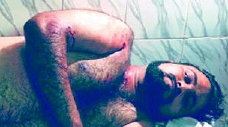 Kashif Jameel was immediately taken to a private nursing home where a bullet lodged in his neck was surgically removed. (Photo: Agencies) Kashif Jameel was immediately taken to a private nursing home where a bullet lodged in his neck was surgically removed. (Photo: Agencies)