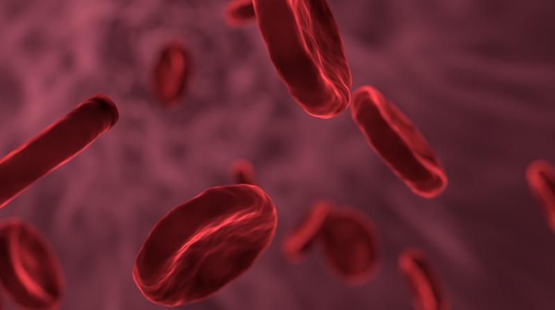Researchers explain how belly fat impacts women with kidney cancer. (Photo: Pixabay) Researchers explain how belly fat impacts women with kidney cancer. (Photo: Pixabay)