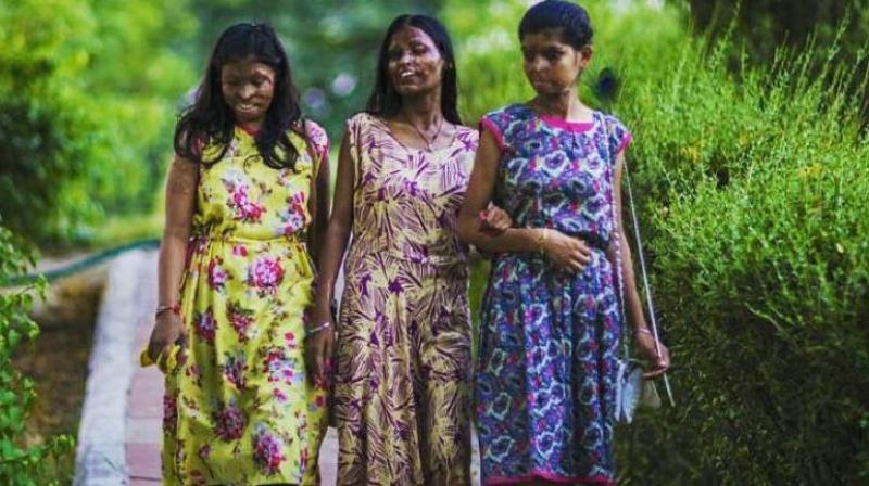 The move may stoke controversy as reservation in promotion for persons with disabilities is before the Supreme Court of India. (Representational Image) The move may stoke controversy as reservation in promotion for persons with disabilities is before the Supreme Court of India. (Representational Image)