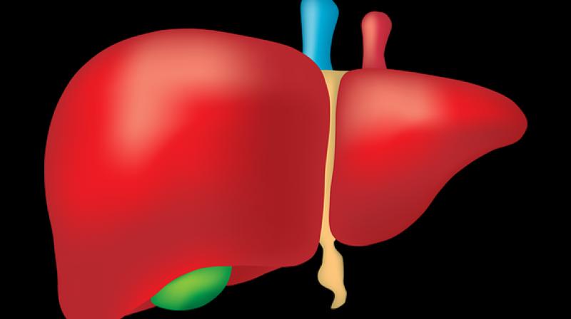 Accurate and precise quantification of liver fat is required to guide treatment of NAFLD with evidence-based weight loss. (Photo: Representational/Pixabay) Accurate and precise quantification of liver fat is required to guide treatment of NAFLD with evidence-based weight loss. (Photo: Representational/Pixabay)