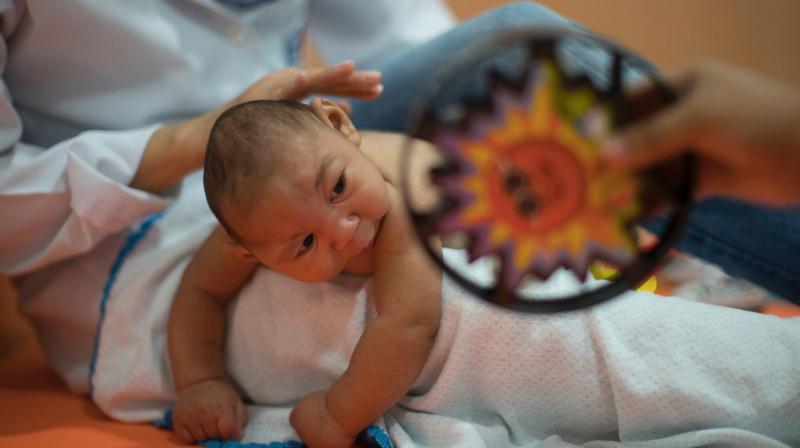 Zika has caused many newborn to be affected by congenital defects like microcephaly. (Photo: AP) Zika has caused many newborn to be affected by congenital defects like microcephaly. (Photo: AP)