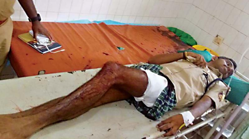 The screams of people who were nearby made the tiger flee the spot and the injured Raghavendra was rushed to a hospital in Gundlupet before being shifted to a private hospital in Mysuru. The screams of people who were nearby made the tiger flee the spot and the injured Raghavendra was rushed to a hospital in Gundlupet before being shifted to a private hospital in Mysuru.