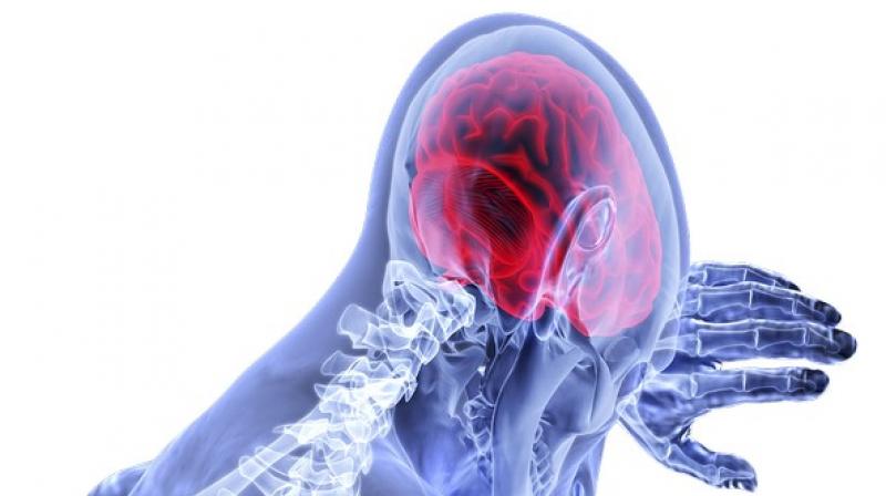 The results of NeuroVISION are important and represent a meaningful discovery that will facilitate tackling the issue of cognitive decline after surgery. (Photo: Photo: ANI) The results of NeuroVISION are important and represent a meaningful discovery that will facilitate tackling the issue of cognitive decline after surgery. (Photo: Photo: ANI)