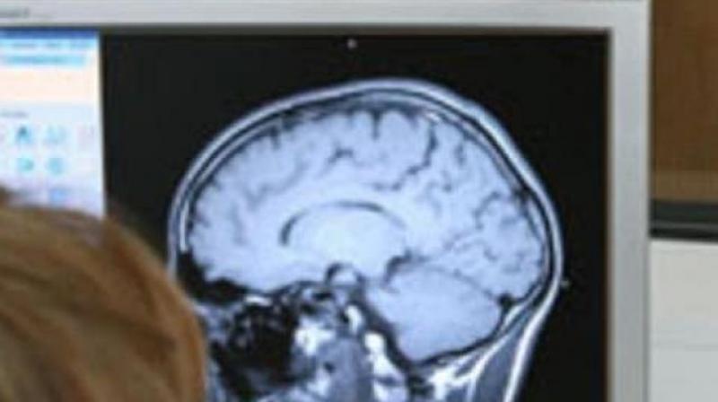Scans reveal 9 cm air filled cavity in 84-year-old man's brain