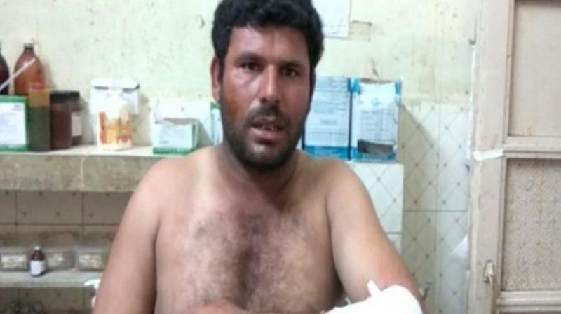 Bhavesh was treated for the injuries at a government hospital in the nearby area. (Photo: ANI) Bhavesh was treated for the injuries at a government hospital in the nearby area. (Photo: ANI)