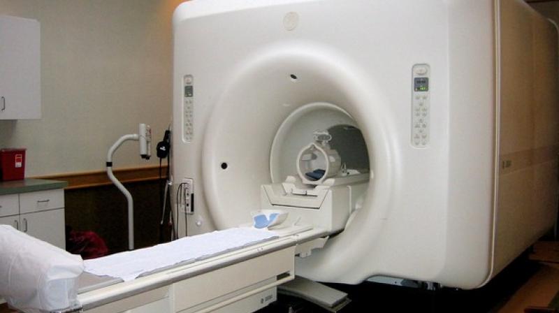 MRI analysis in patients with stroke-related, small vessel disease, helped predict problems with thinking, memory and even dementia. (Photo: ANI) MRI analysis in patients with stroke-related, small vessel disease, helped predict problems with thinking, memory and even dementia. (Photo: ANI)