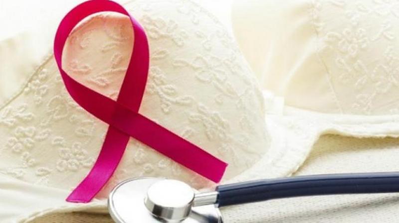 Researchers discover possible treatment for breast cancer. (Photo: AFP) Researchers discover possible treatment for breast cancer. (Photo: AFP)